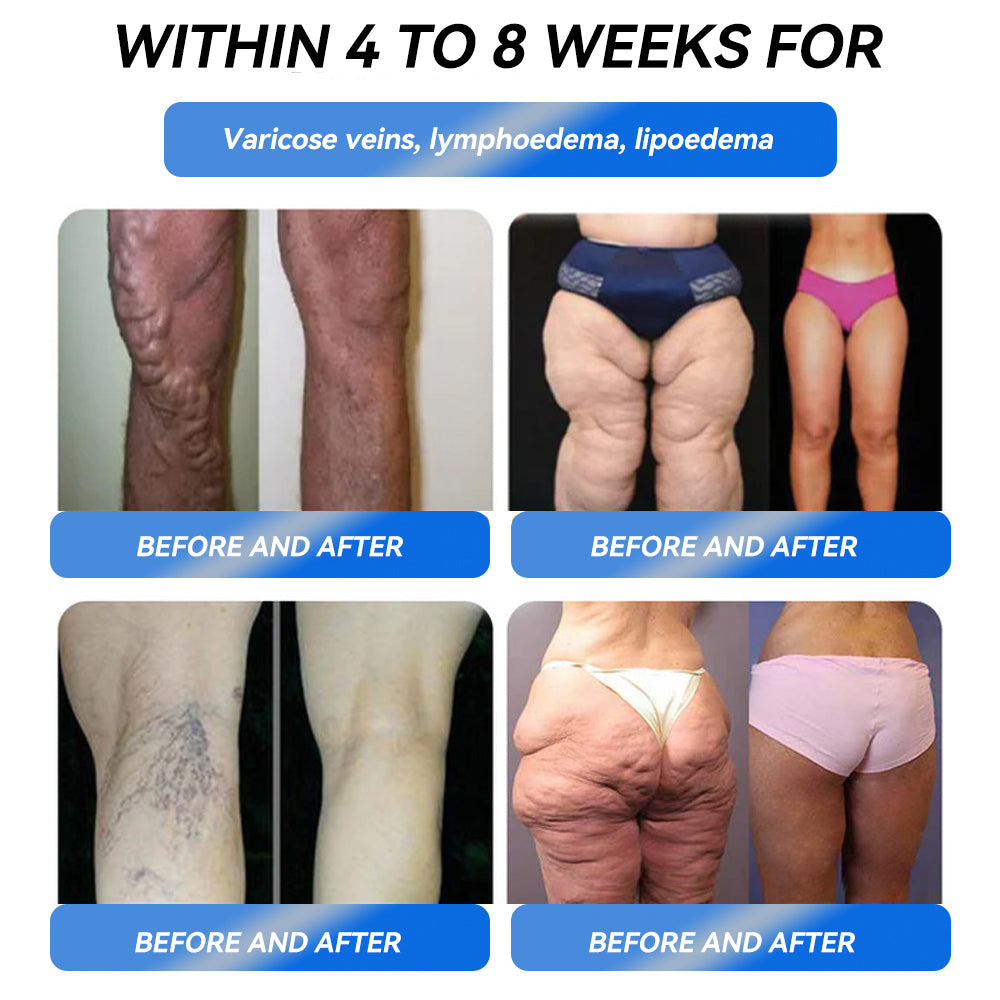 IFMAGIC® GLP-1 Pro Weight Loss Oral Solution👩⚕️One dose a day — see results in 7 days🔥Suitable for obesity, cardiovascular diseases, diabetes, sleep apnea, high cholesterol and blood lipids, joint problems, and various other conditions🌺